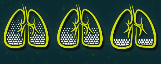 COPD stages in seniors